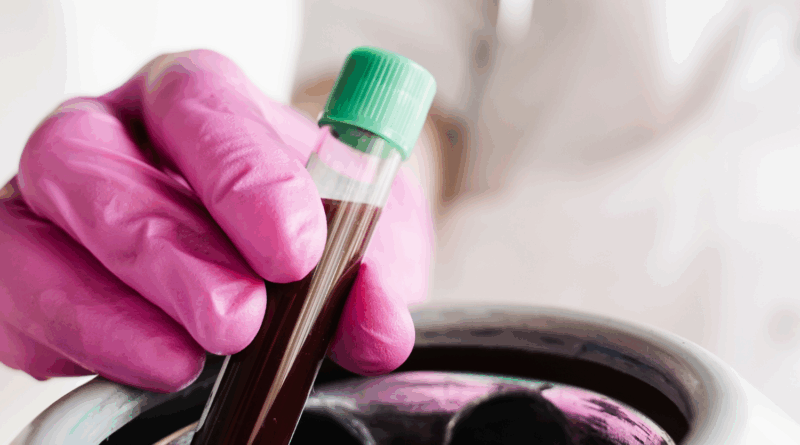 Eu doei plasma como uma agitação lateral